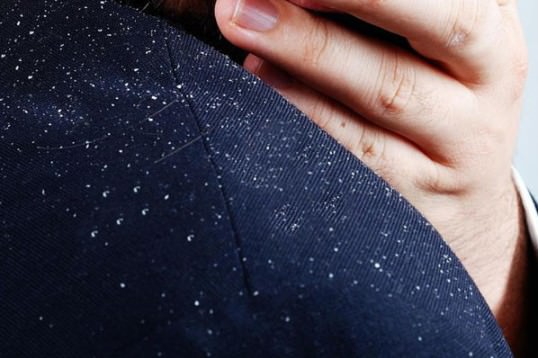 Homemade Remedies For Dandruff Homemade Remedies For Dandruff