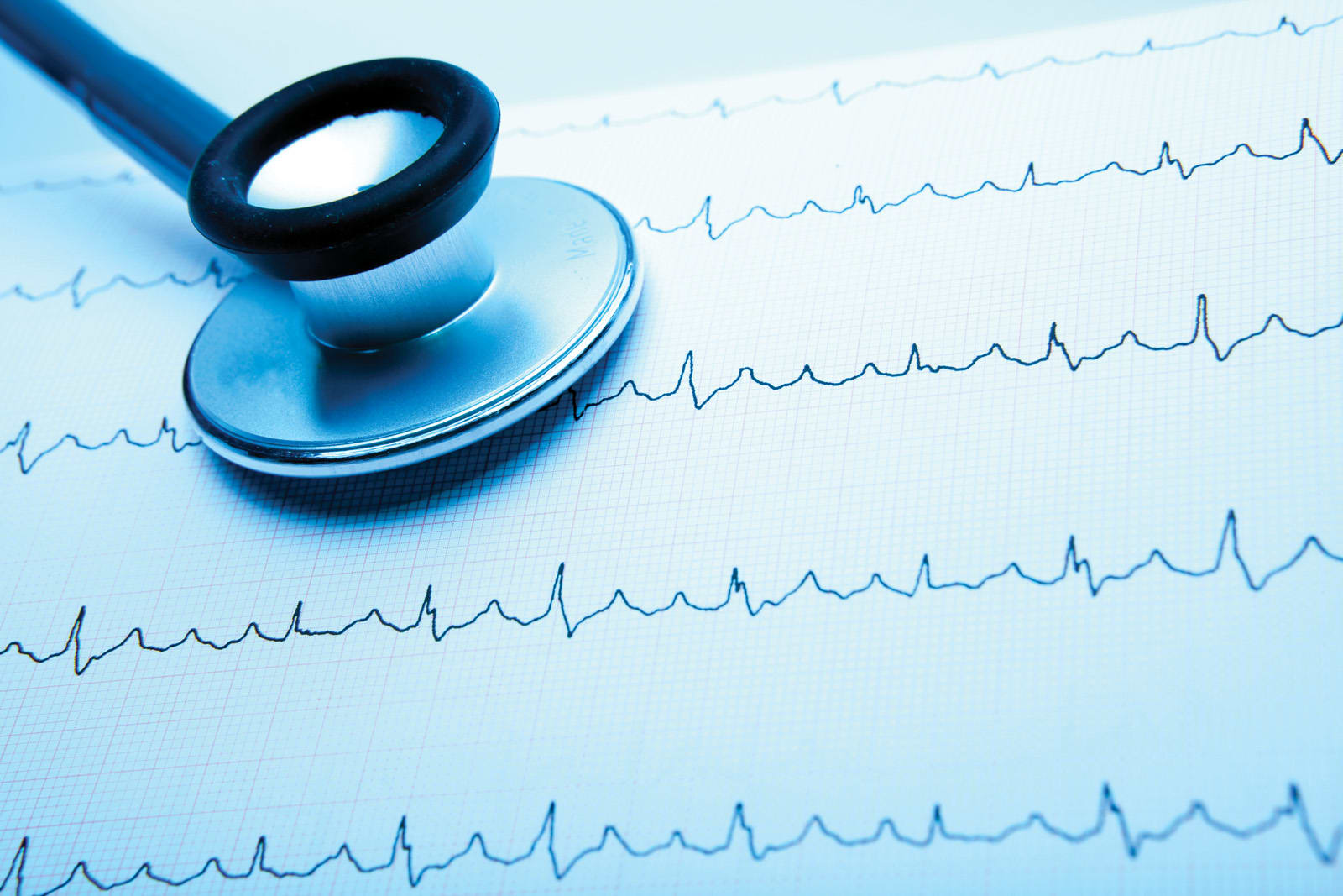 Cardiac Testing