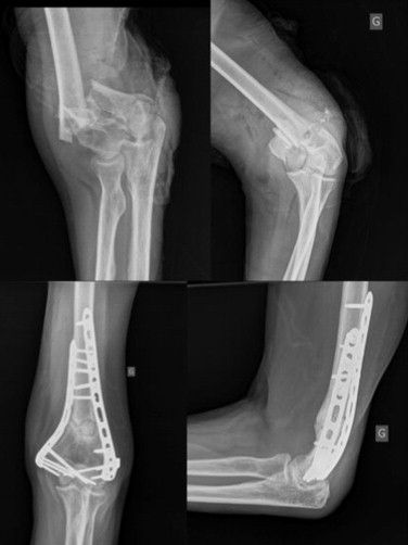 Dr Mohamed Amine Ouzif