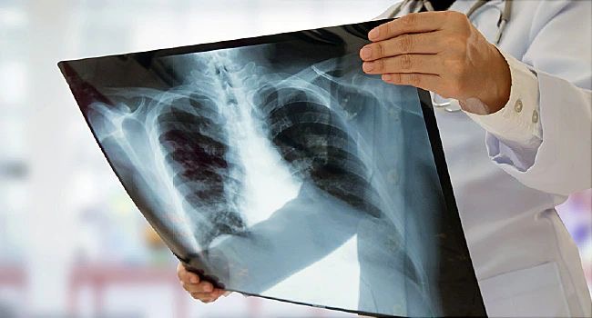 Dr Ahmed Benhammouda