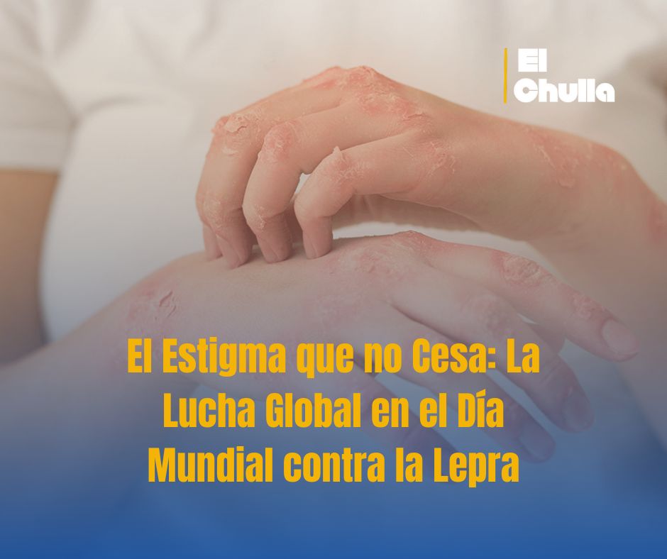 El Estigma que no Cesa: La Lucha Global en el Día Mundial contra la Lepra