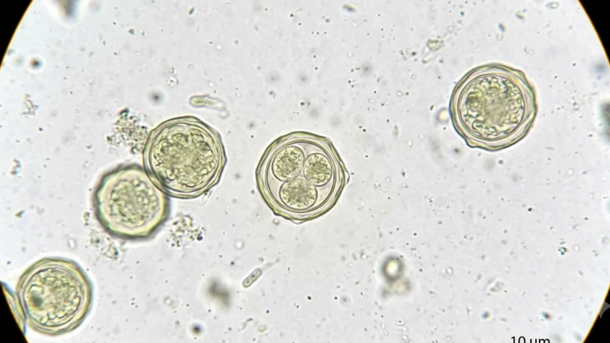 Brote de parasito Cyclospora se extiende a 31 estados de EE.UU. con casi 2.000 casos