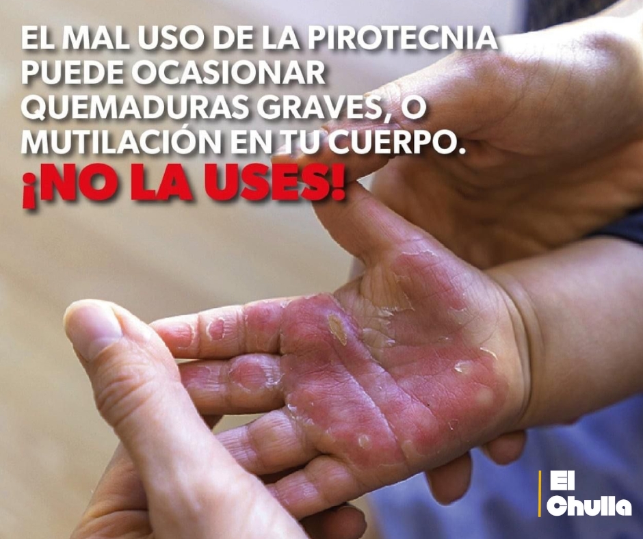 Autoridades alertan sobre los riesgos de la pirotecnia y sus secuelas permanentes.