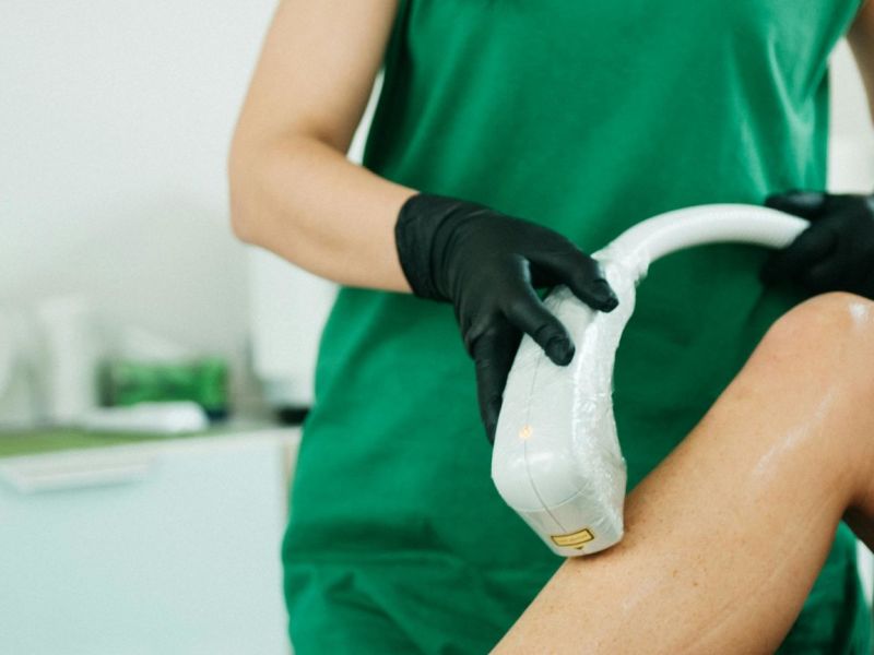 laser hair removal photo