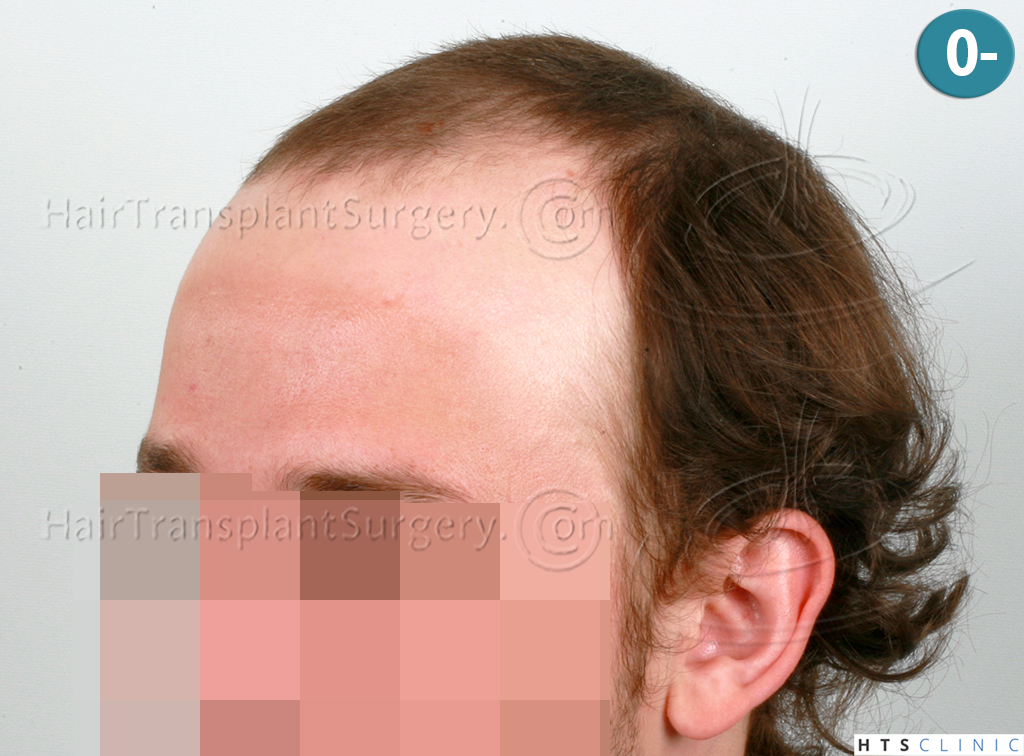 Dr.Devroye-HTS-Clinic-6103FUT_3722_2381_-NW-IV-3.jpg