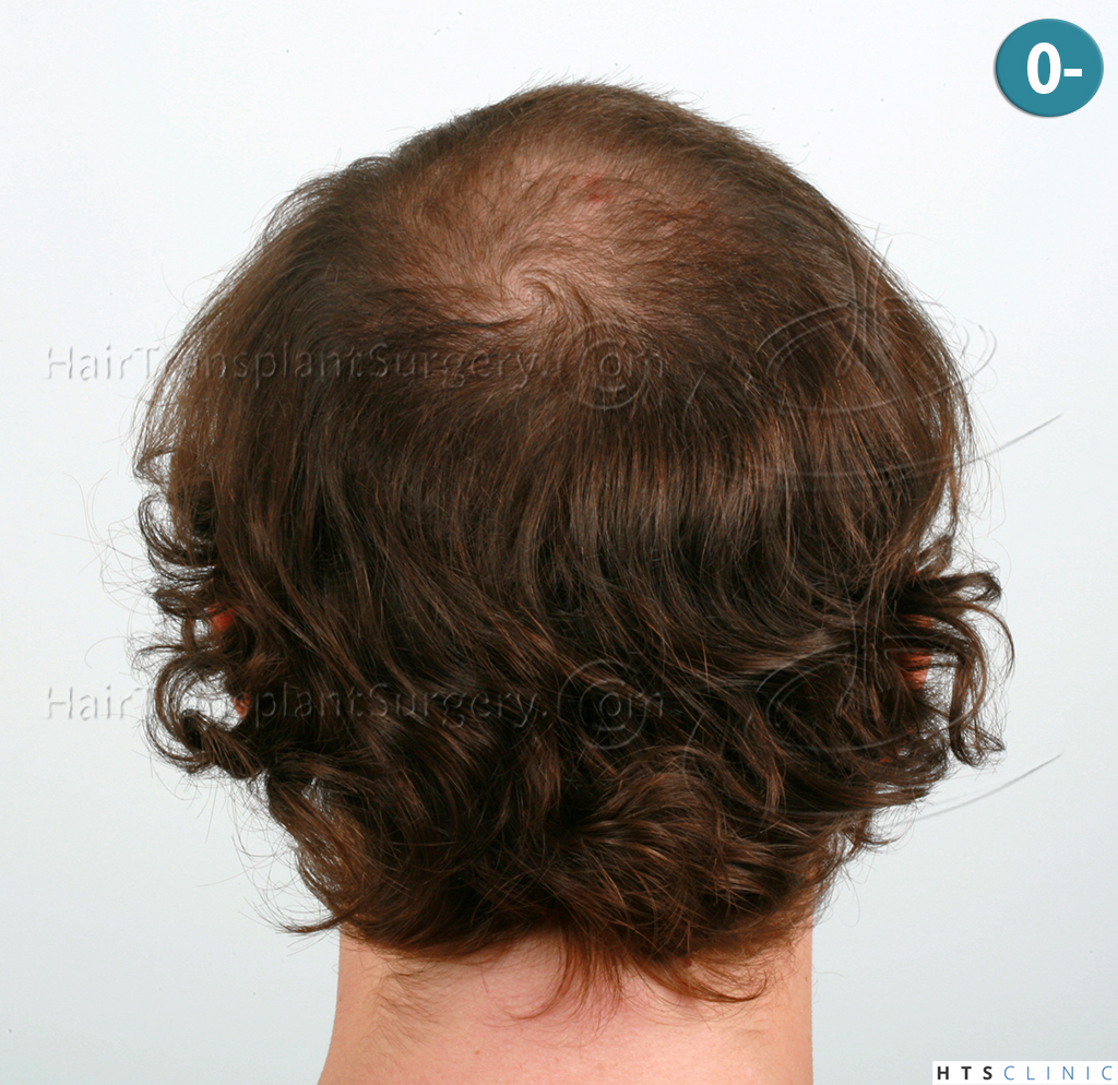 Dr.Devroye-HTS-Clinic-6103FUT_3722_2381_-NW-IV-5.jpg