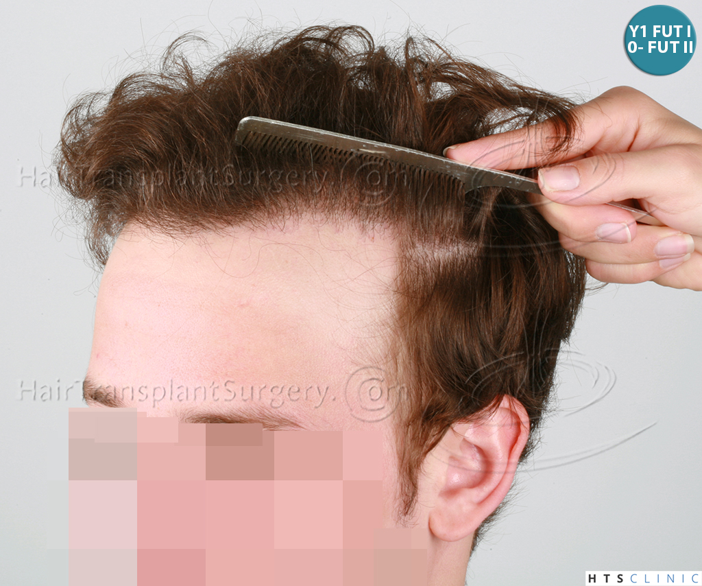 Dr.Devroye-HTS-Clinic-6103FUT_3722_2381_-NW-IV-15.jpg