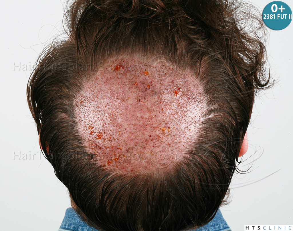 Dr.Devroye-HTS-Clinic-6103FUT_3722_2381_-NW-IV-20.jpg