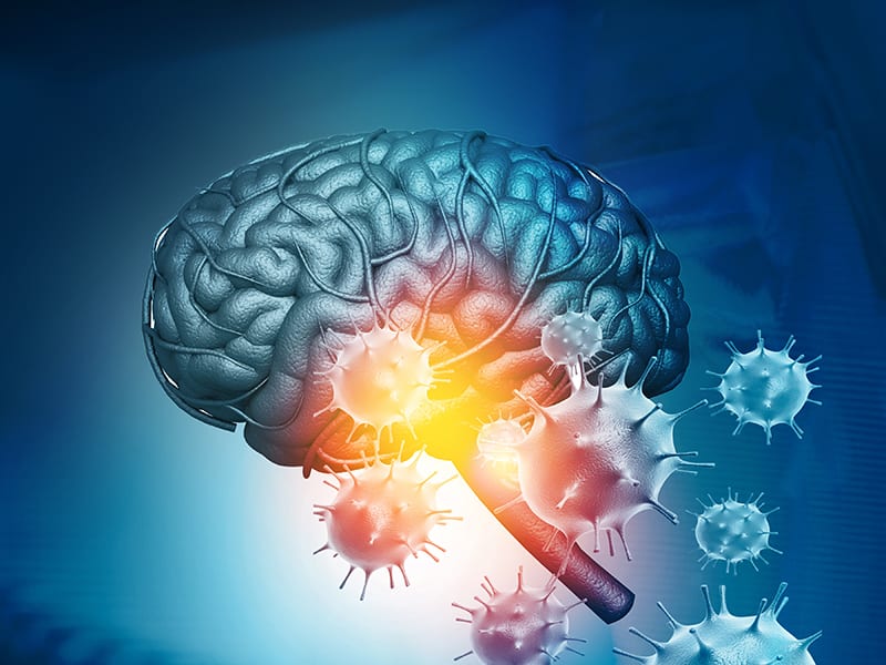 Stylized image of brain and viruses. Links to: Information for researchers regarding COVID-19 and epilepsy