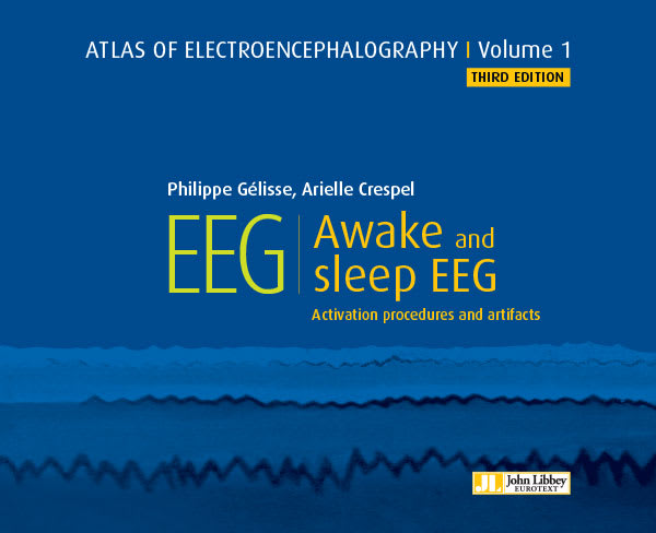Atlas of electroencephalography - Volume 1 : Awake and sleep EEG (3rd edition)