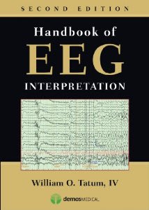 Handbook of EEG Interpretation, 2nd ed.
