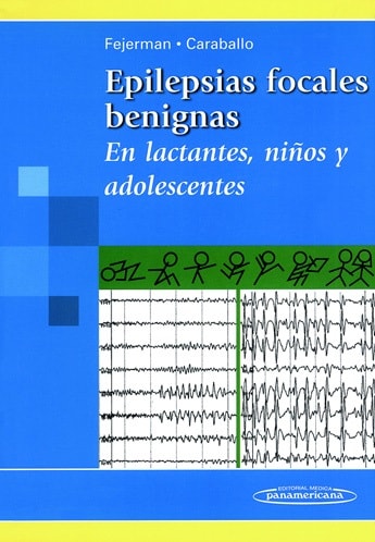 Epilepsias focales benignas