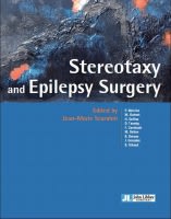 Stereotaxy and Epilepsy surgery