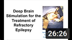 Deep brain stimulation for the treatment of refractory epilepsy: Anatomy, Technique, Complications - click for YouTube
