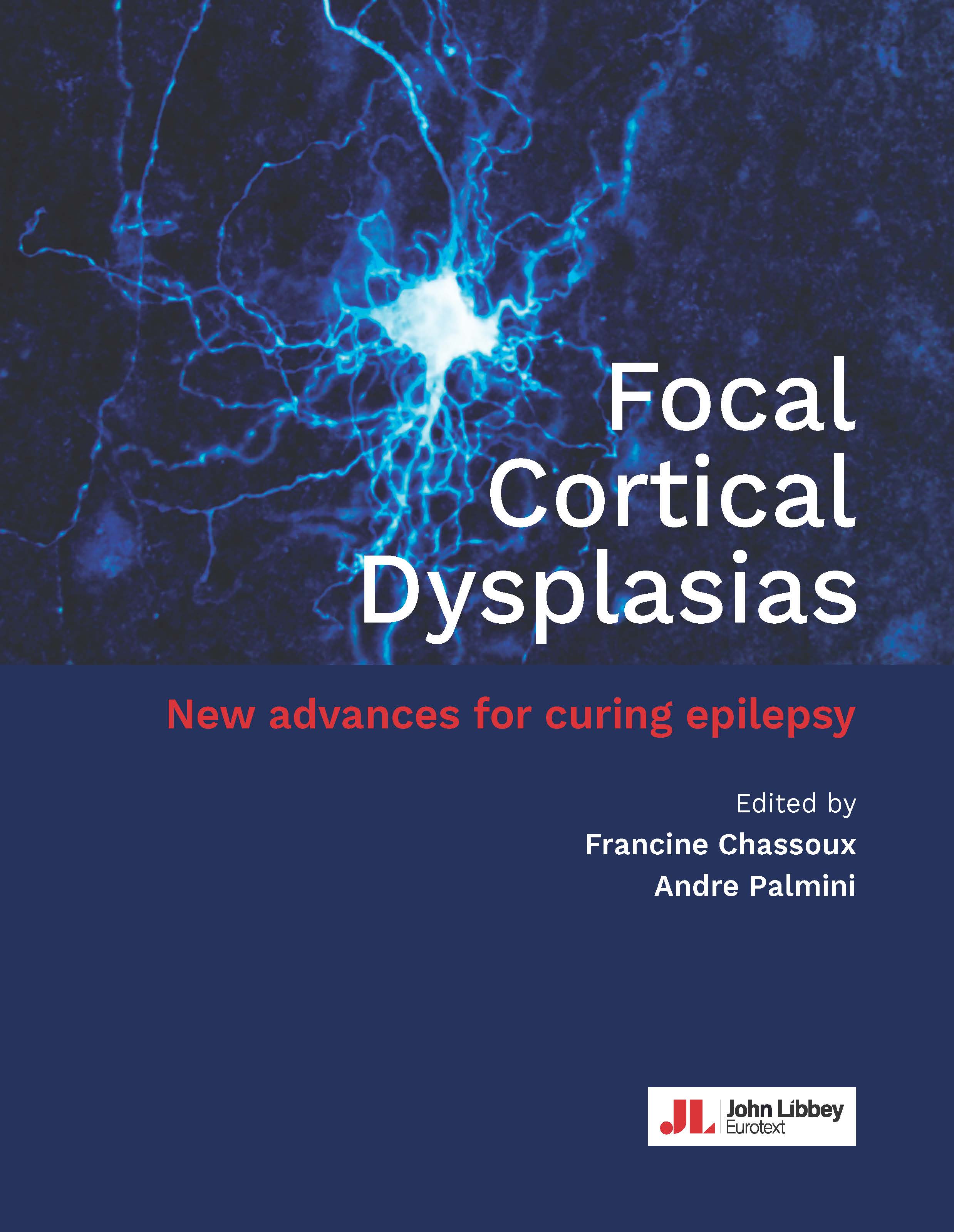 Focal Cortical Dysplasias: New advances for curing epilepsy