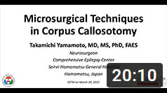Microsurgical techniques in corpus callosotomy: Anatomy, Technique, Complications video - click for YouTube