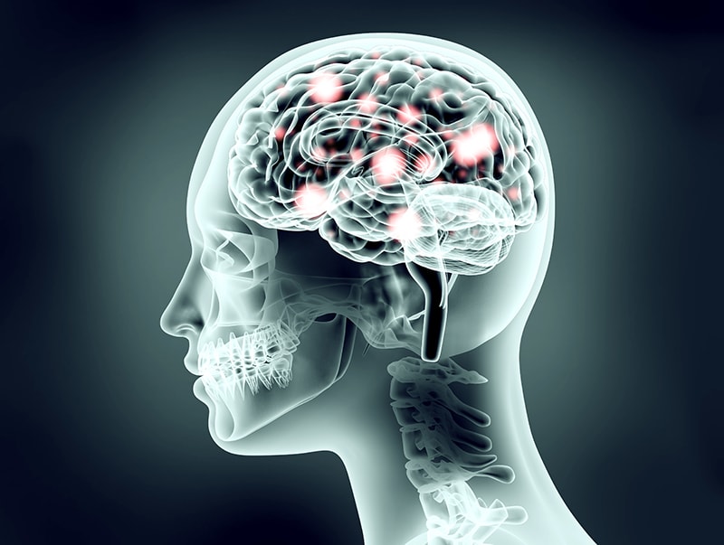 Stylized x-ray from neck up including brain