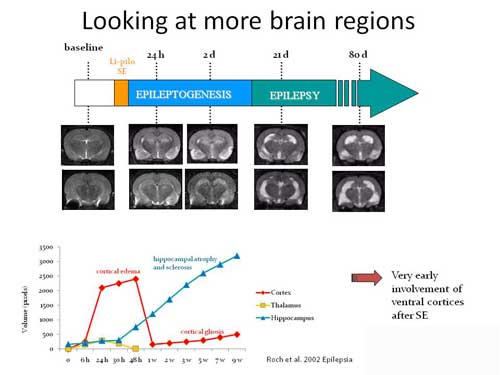 Figure 1: Time course of some of the changes that happen during the development of epilepsy after an episode of Status Epilepticus induced by lithium-pilocarpine.