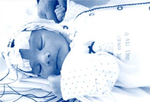 Neonatal image