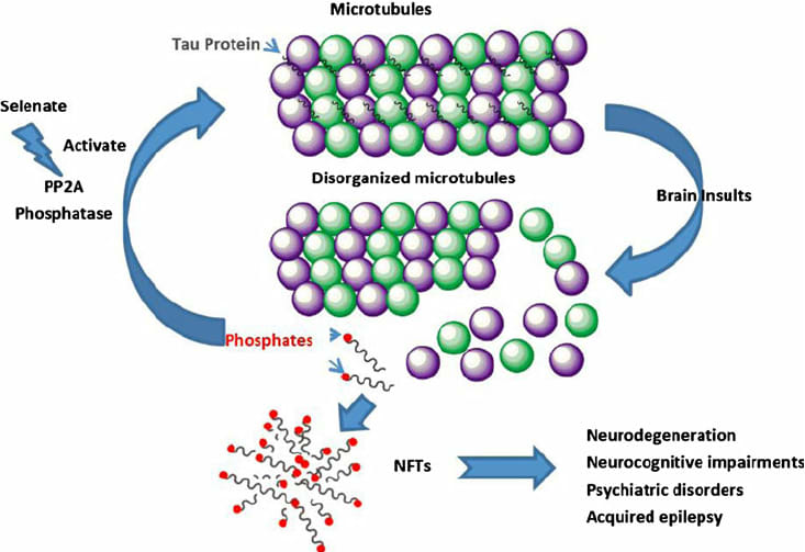 Abnormal phosphorylation of tau causes microtubule depolymerization and the formation of insoluble cytoplasmic p-tau, which aggregate and assemble to form neurofibrillary tangles (NFTs)