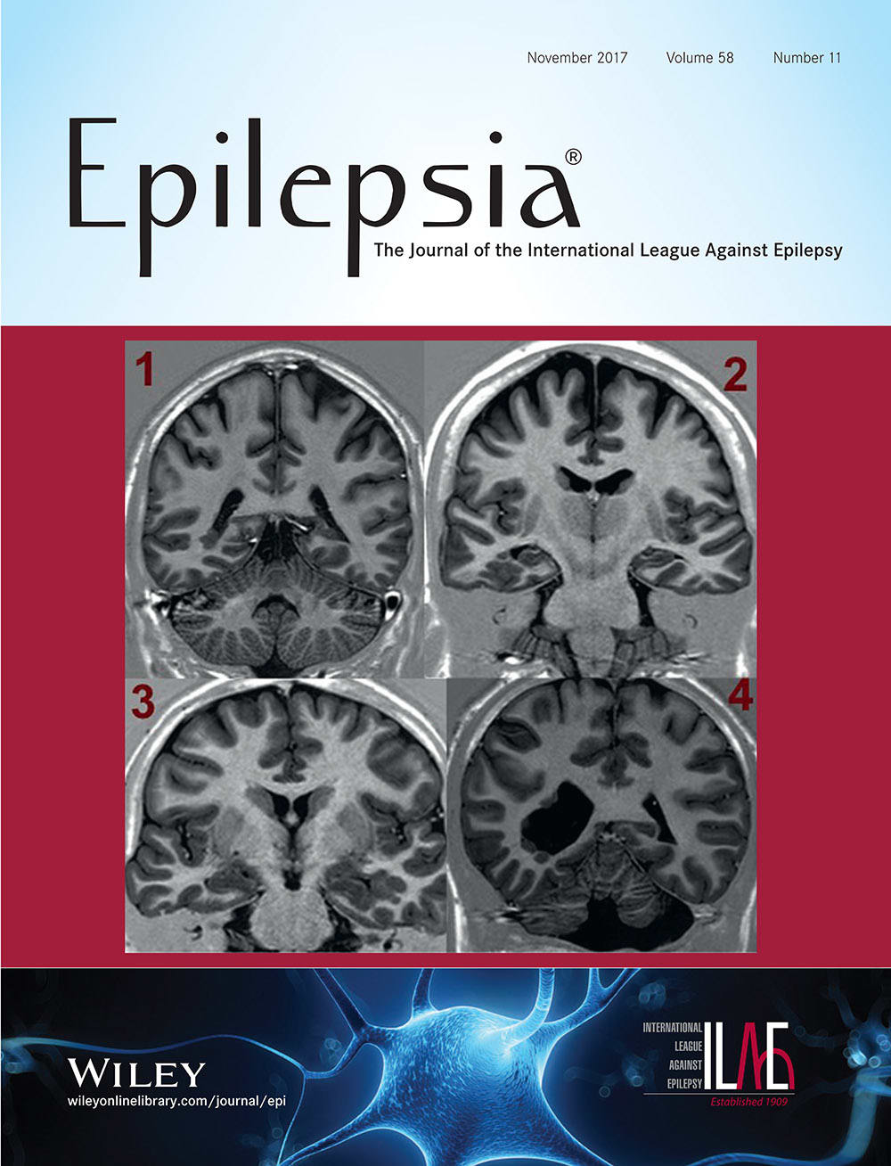 Epilepsia Cover current