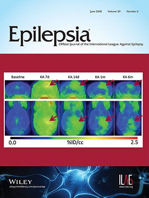 Epilepsia cover June 2018