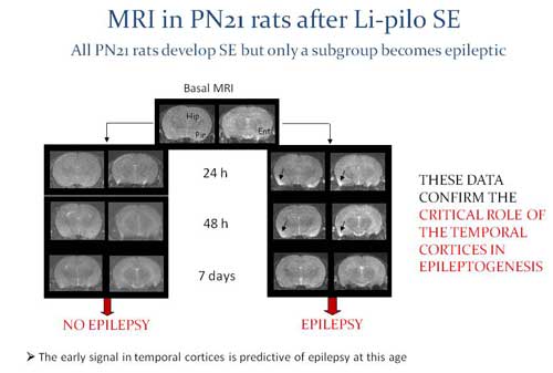 Figure 2: Injury of temporal cortices predicts development of epilepsy.
All of the young rats (21 days old) develop Status Epilepticus, but only those with injury develop epilepsy.