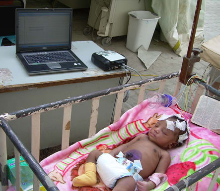 Newborn with neonatal seizures undergoing EEG evaluation in a tent housing the neonatal care unit at University Hospital.