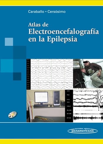 Atlas de Electroencefalografía en la Epilesia