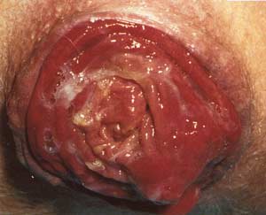 Ortacha vaznli qizlar jinsi