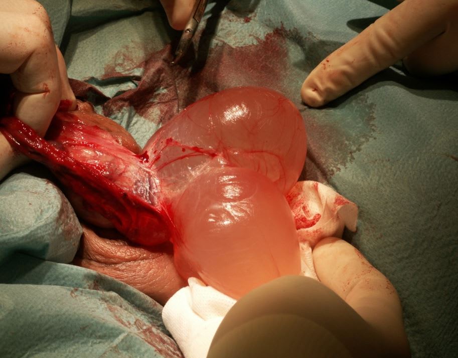 Chimkentdagi jinsiy aloqa