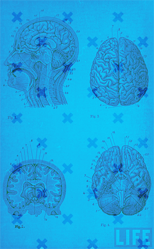 brain-memory-fail-social-media Internet use, memory and Social Media