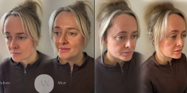 Before And After