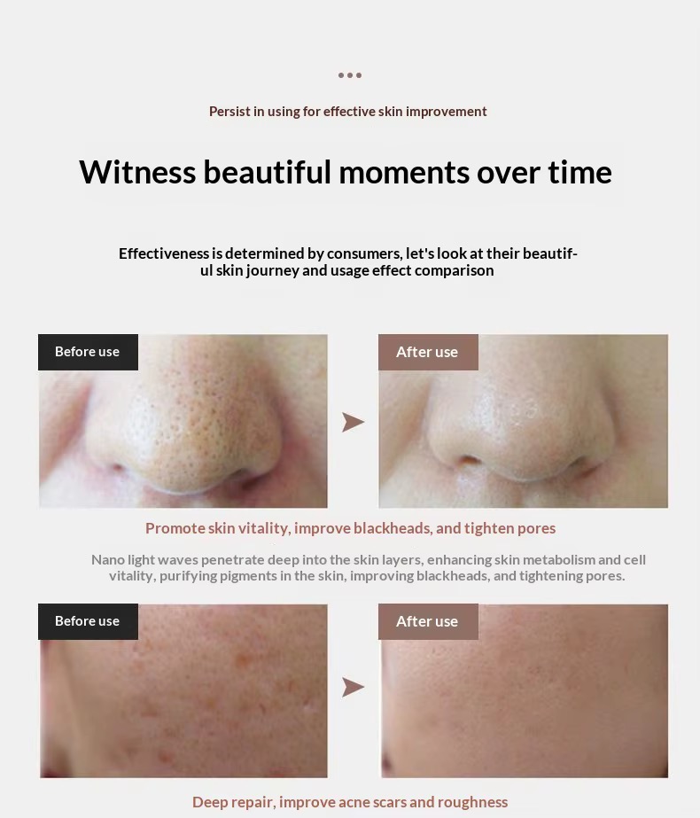 Wireless Rechargeable 7-Color LED Beauty Mask