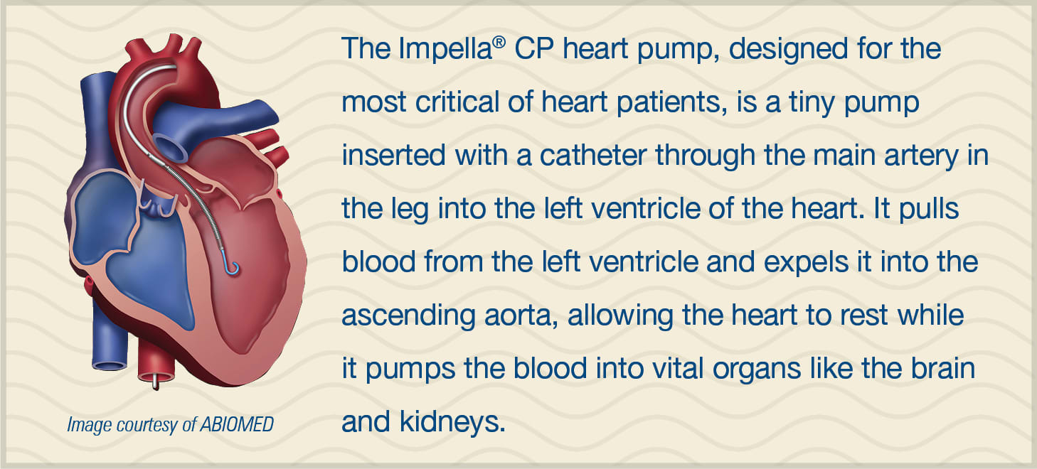 Impella® CP Heart Pump