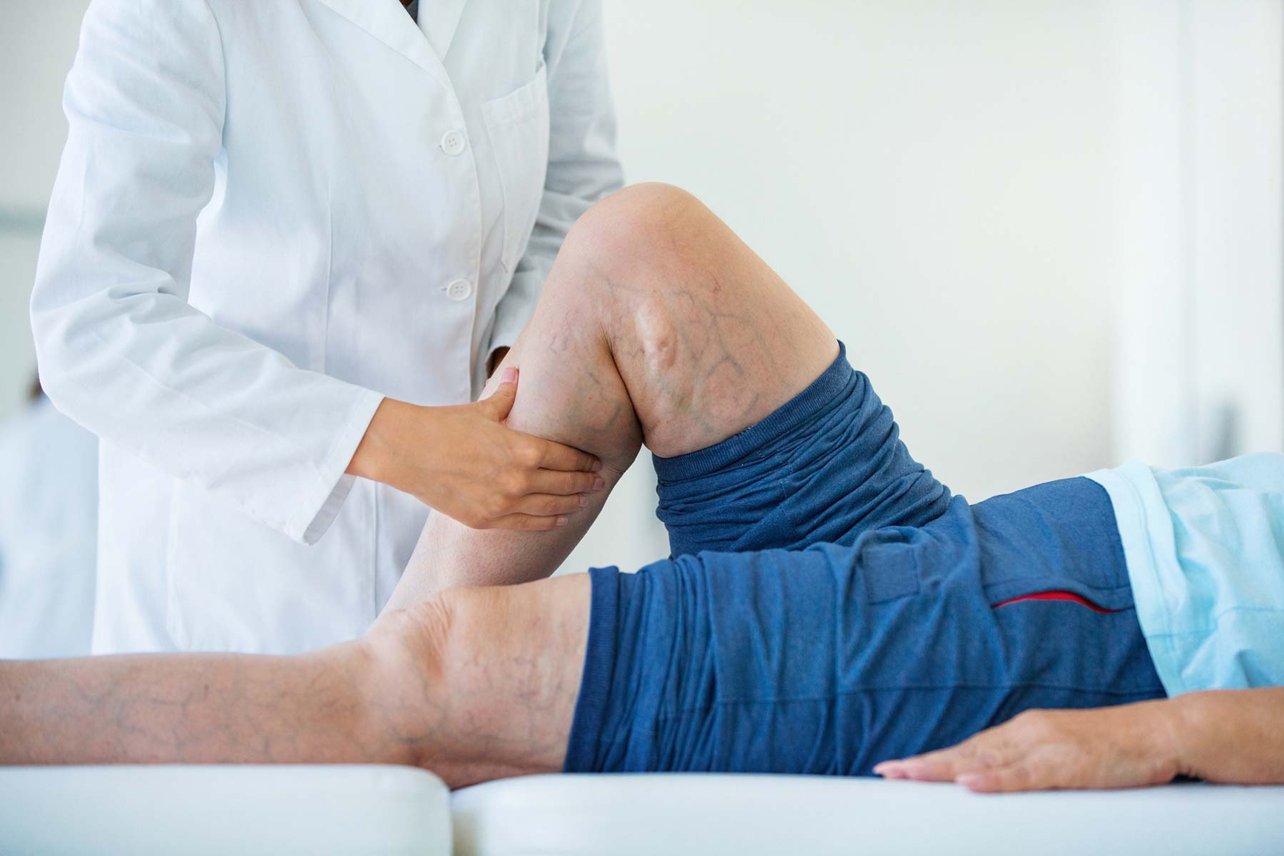 Vein Center - provider checking patient with varicose veins