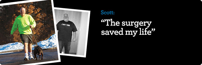 Scott Rossi before & after
