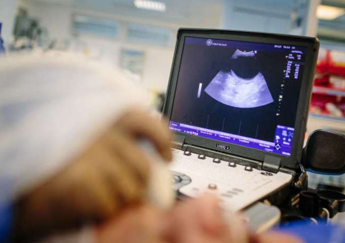RA in ultrasound-guided ophthalmology