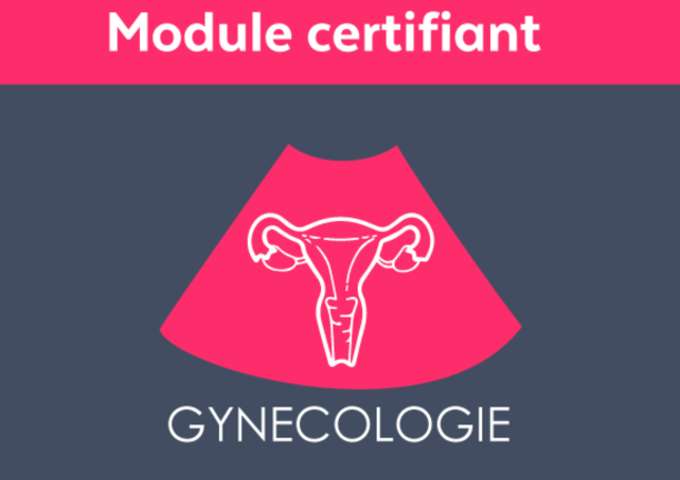 Echographie gynécologique débutant