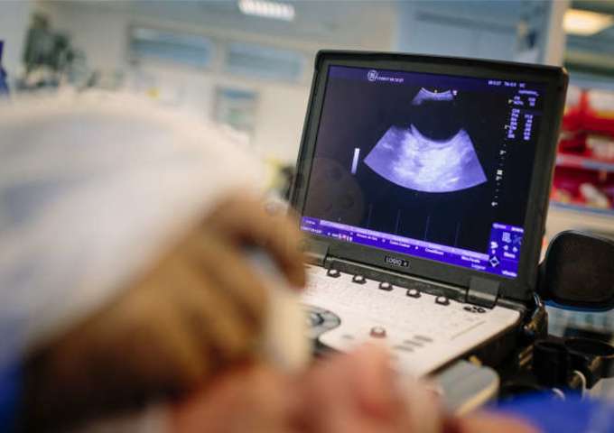 Echographie adaptée aux patients de réanimation : DTC, eFAST, cardiaque, pleuro-pulmonaire