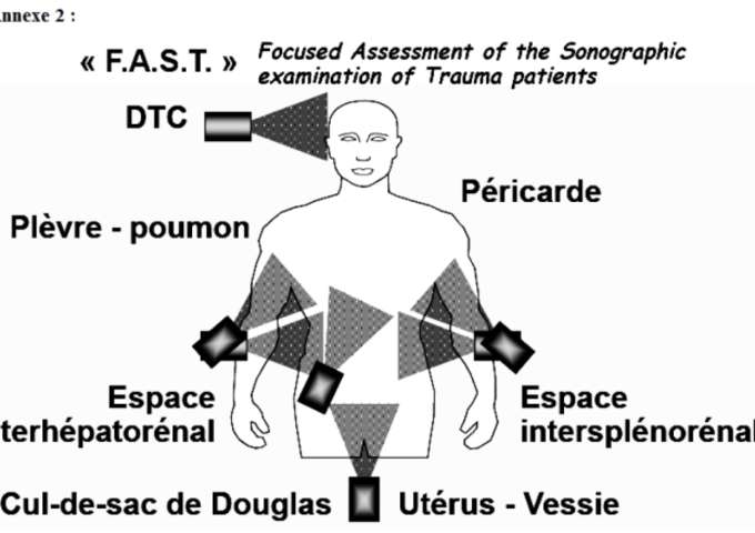FAST Echo aux urgences
