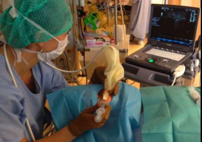 Petits Blocs de la FACE sous Echographie