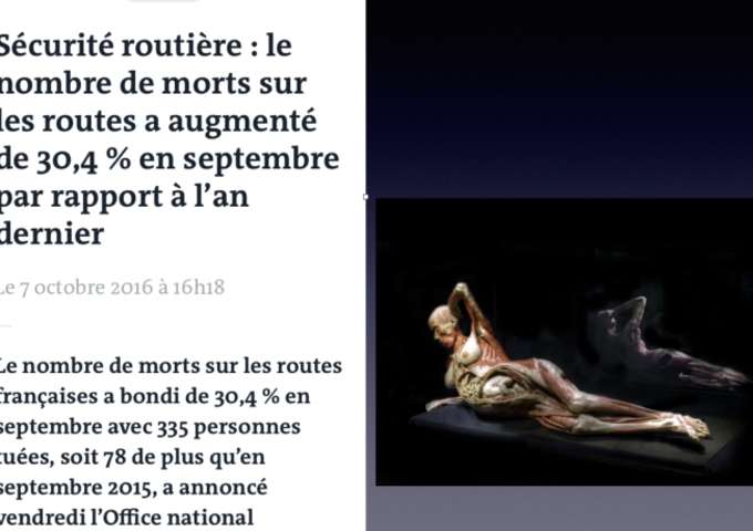 Le choc hémorragique traumatique version expert