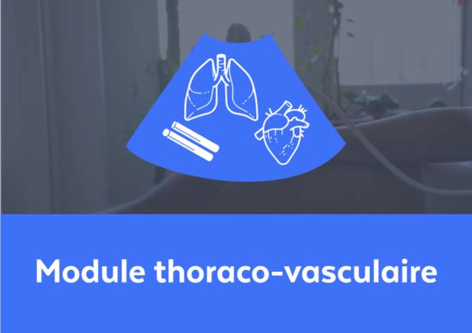 Module thoraco-vasculaire 10h / e-learning + webconf