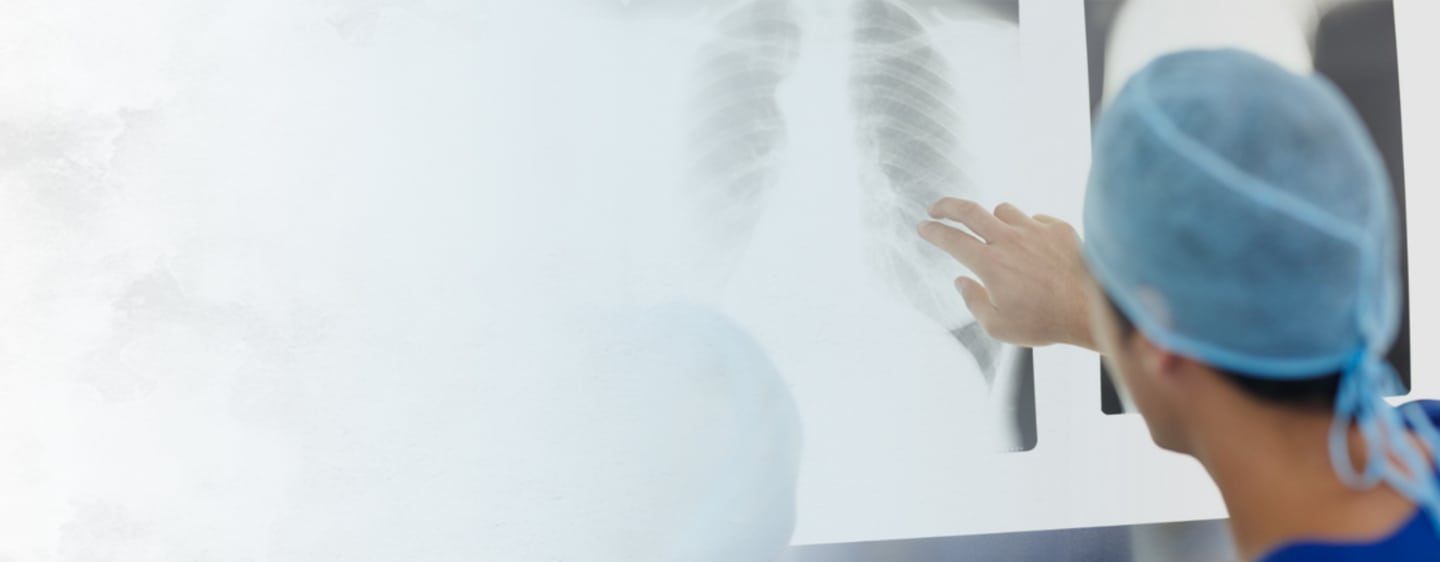 da Vinci® Robot-Assisted Thoracic Surgery