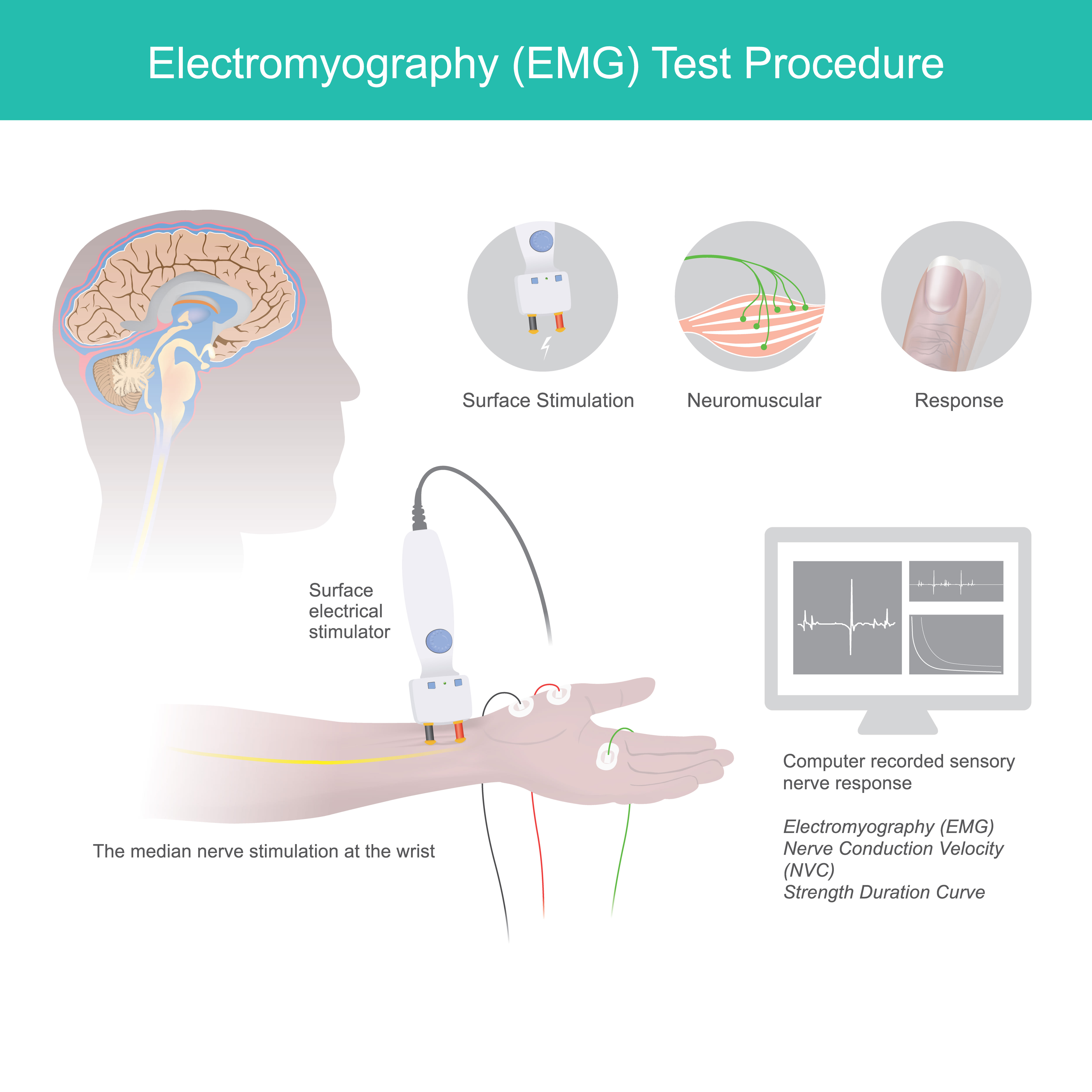 EMG