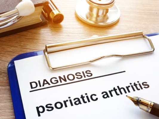 psoriatic arthritis