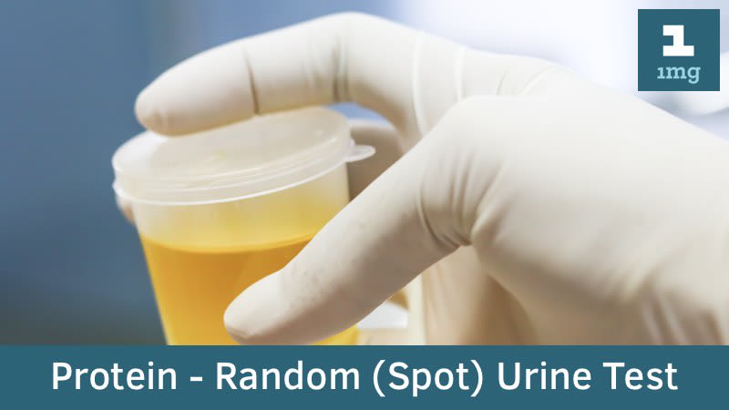 Protein - Random (Spot) Urine
