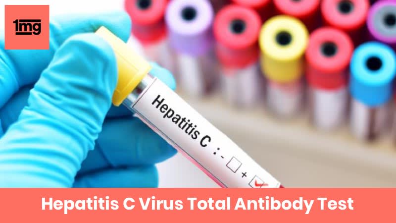 Hepatitis C Virus Total Antibody Test