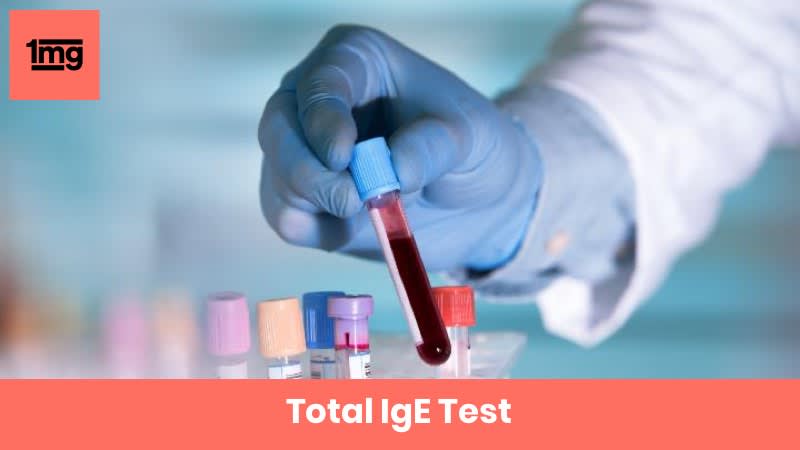 Total IgE Test